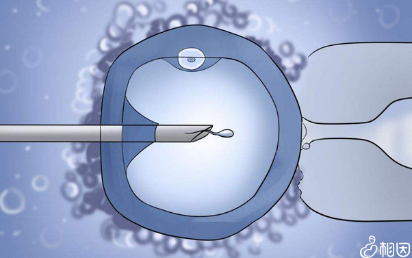胚胎移植过程  试管婴儿移植过程视频